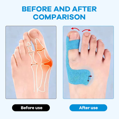 Voorgesneden kinesiologietape voor hallux valgus